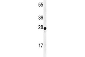 Western blot analysis of AANAT antibody and human Y79 lysate. (AANAT Antikörper  (AA 27-54))