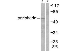 Western blot analysis of extracts from HepG2 cells, using Peripherin antibody (ABIN5976490). (Peripherin Antikörper  (C-Term))