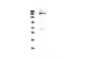 Western blot analysis of Dnmt1 using anti-Dnmt1 antibody .