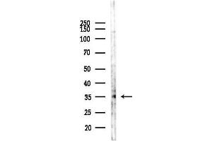 anti-Kruppel-Like Factor 16 (KLF16) (C-Term) antibody