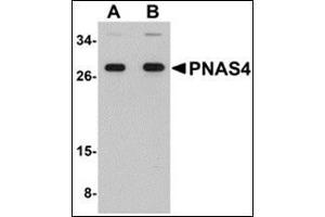 Western blot analysis of PNAS4 in EL4 cell lysate with this product at (A) 1 and (B) 2 μg/ml. (PPPDE1 Antikörper  (C-Term))