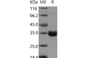 Western Blotting (WB) image for Collectin Sub-Family Member 11 (COLEC11) protein (His tag) (ABIN7195181)