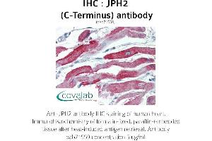 Image no. 1 for anti-Junctophilin 2 (JPH2) (C-Term) antibody (ABIN1736131) (Junctophilin 2 Antikörper  (C-Term))
