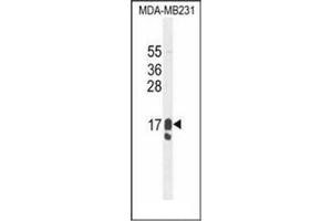 Western blot analysis of PIP / GCDFP15 Antibody (C-term) in MDA-MB231 cell line lysates (35ug/lane). (PIP Antikörper  (C-Term))