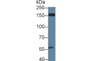 Detection of DAG1 in Mouse Placenta lysate using Polyclonal Antibody to Dystrophin Associated Glycoprotein 1 (DAG1) (Dystroglycan Antikörper  (AA 28-406))