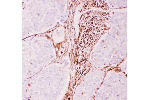 Immunohistochemistry (IHC) image for anti-ATP-Binding Cassette, Sub-Family B (MDR/TAP), Member 1 (ABCB1) (AA 621-650), (Middle Region) antibody (ABIN3043967)
