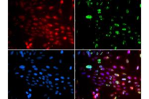 Immunofluorescence analysis of GFP-RNF168 transgenic U2OS cells using L3MBTL1 antibody (ABIN5974264). (L3MBTL1 Antikörper)