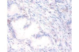 Immunohistochemistry of paraffin-embedded human prostate tissue using ABIN7169381 at dilution of 1:100 (PON1 Antikörper  (AA 2-355))