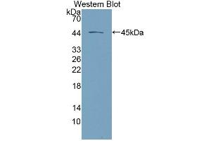 Western blot analysis of the recombinant protein. (Desmoglein 2 Antikörper  (AA 275-533))