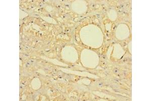Immunohistochemistry of paraffin-embedded human skin tissue using ABIN7142622 at dilution of 1:100 (HTR2A Antikörper  (AA 385-471))