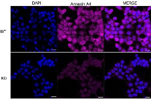 Immunocytochemical staining of HeLa cells using annexin A4 antibody (ABIN7797620), 1:1,000), Top panel: wild-type (WT), Bottom panal: Annexin A4 shRNA knockdown (KD).