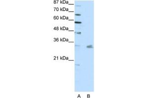 Western Blotting (WB) image for anti-Pituitary Homeobox 3 (PITX3) antibody (ABIN2461738) (PITX3 Antikörper)