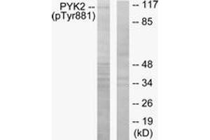 Western blot analysis of extracts from mouse brain, using PYK2 (Phospho-Tyr881) Antibody.