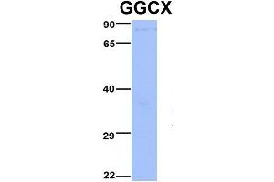 Host:  Rabbit  Target Name:  GGCX  Sample Type:  Jurkat  Antibody Dilution:  1. (GGCX Antikörper  (Middle Region))