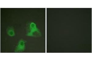Immunofluorescence analysis of HeLa cells, using ADD1 (Phospho-Ser726) Antibody. (alpha Adducin Antikörper  (pSer726))