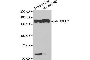 Western blot analysis of extracts of various cell lines, using ARHGEF2 antibody. (ARHGEF2 Antikörper)