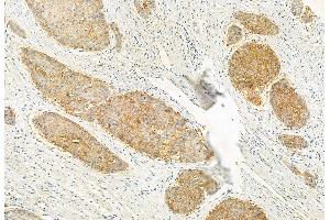 ABIN6262205 and ABIN6272919 at 1/100 staining Human normal tissues adjacent to esophageal cancer by IHC-P.