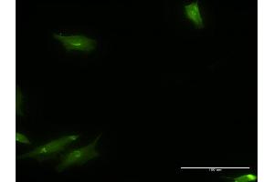 Immunofluorescence of monoclonal antibody to CAMKK1 on HeLa cell. (CAMKK1 Antikörper  (AA 2-100))
