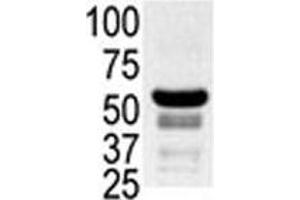 Western blot testing of ovary lysate with PAK2 antibody. (PAK2 Antikörper  (AA 192-222))