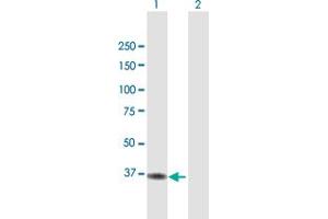 Western Blot analysis of ACAD8 expression in transfected 293T cell line by ACAD8 MaxPab polyclonal antibody. (Acad8 Antikörper  (AA 1-415))