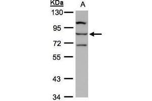 WB Image Sample(30 ug whole cell lysate) A:Hep G2 , 7. (ALOXE3 Antikörper)