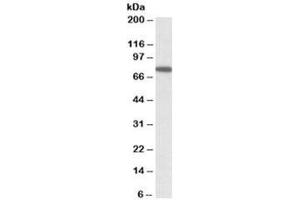 Western blot testing of HeLa lysate with SNX1 antibody at 1ug/ml. (Sorting Nexin 1 Antikörper)