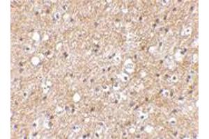 Immunohistochemical staining of human brain tissue using SP110 polyclonal antibody  at 2. (SP110 Antikörper  (C-Term))