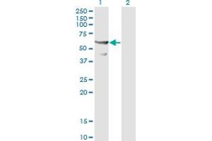 Western Blot analysis of CDC45L expression in transfected 293T cell line by CDC45L monoclonal antibody (M01), clone 3F11-1F3. (CDC45 Antikörper  (AA 1-566))