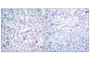 Immunohistochemistry (IHC) image for anti-Jun Proto-Oncogene (JUN) (pSer63) antibody (ABIN1847456) (C-JUN Antikörper  (pSer63))