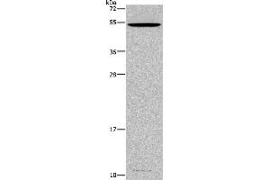 Western blot analysis of Mouse testis tissue, using CATSPER3 Polyclonal Antibody at dilution of 1:350 (CATSPER3 Antikörper)