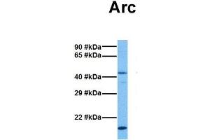 Host:  Rabbit  Target Name:  Arc  Sample Tissue:  Mouse Brain  Antibody Dilution:  1. (ARC (Middle Region) Antikörper)