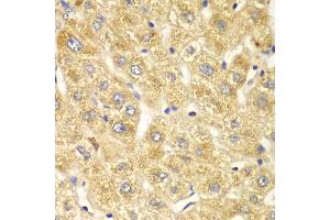 Immunohistochemistry of paraffin-embedded human liver injury using OGT antibody (ABIN4904611) at dilution of 1:100 (40x lens). (OGT Antikörper)