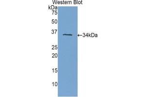 Detection of Recombinant PLXNB1, Human using Polyclonal Antibody to Plexin B1 (PLXNB1) (PLXNB1 Antikörper  (AA 1780-2042))