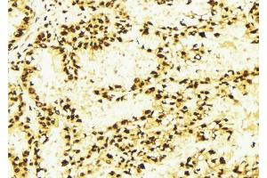 ABIN6269385 at 1/100 staining Human lung tissue by IHC-P.