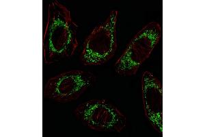 Fluorescent image of A549 cell stained with OAT Antibody (N-term) (ABIN652844 and ABIN2842548)/SA100310AG. (OAT Antikörper  (N-Term))