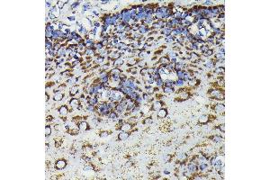 Immunohistochemistry (IHC) image for anti-Superoxide Dismutase 2, Mitochondrial (SOD2) antibody (ABIN7270638)