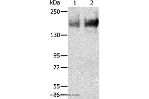 Western blot analysis of Human jejunoileum and ileum tissue, using TRPM6 Polyclonal Antibody at dilution of 1:200 (TRPM6 Antikörper)