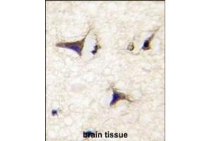 anti-Dishevelled Associated Activator of Morphogenesis 2 (DAAM2) (AA 68-97), (N-Term) antibody