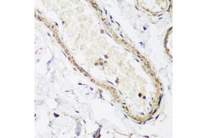Immunohistochemistry of paraffin-embedded human colon using CAV3 antibody (ABIN5974782) at dilution of 1/200 (40x lens). (Caveolin 3 Antikörper)
