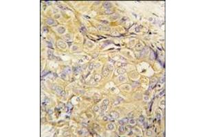 Image no. 1 for anti-Fibroblast Growth Factor 10 (FGF10) (C-Term) antibody (ABIN360398)