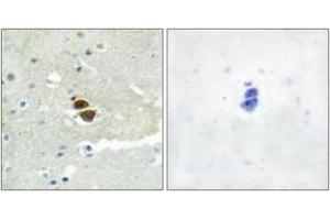 Immunohistochemistry analysis of paraffin-embedded human brain, using n-NOS (Phospho-Ser852) Antibody. (NOS1 Antikörper  (pSer852))