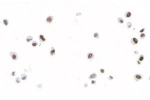 Immunocytochemistry (ICC) image for anti-Forkhead Box C2 (MFH-1, Mesenchyme Forkhead 1) (FOXC2) (AA 215-265) antibody (ABIN7453342)