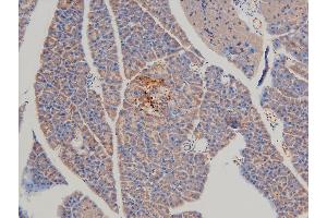 Immunohistochemistry (IHC) image for anti-LIM Domain Kinase 1 (LIMK1) (pThr508) antibody (ABIN6255701)