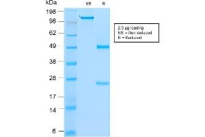 SDS-PAGE Analysis Purified MyoD1 Mouse Recombinant Monoclonal Antibody (rMYD712). (Rekombinanter MYOD1 Antikörper)
