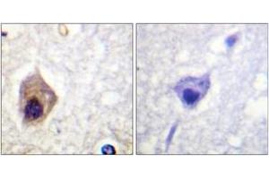 Immunohistochemistry analysis of paraffin-embedded human brain tissue, using Caspase 1 (Ab-376) Antibody. (Caspase 1 Antikörper  (AA 342-391))