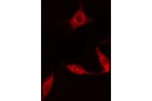 ABIN6278006 staining  HuvEc cells by IF/ICC. (DAPK3 Antikörper  (Internal Region))