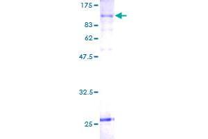 SLC20A1 Protein (AA 1-679) (GST tag)