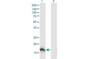 Western Blot analysis of SOD1 expression in transfected 293T cell line by SOD1 monoclonal antibody (M04), clone 10D5. (SOD1 Antikörper  (AA 1-154))