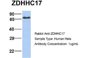Host:  Rabbit  Target Name:  ZDHHC17  Sample Type:  Hela  Antibody Dilution:  1. (ZDHHC17 Antikörper  (Middle Region))