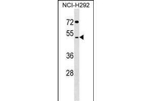 SUDS3 Antibody (N-term) (ABIN1539569 and ABIN2849245) western blot analysis in NCI- cell line lysates (35 μg/lane). (SDS3 Antikörper  (N-Term))